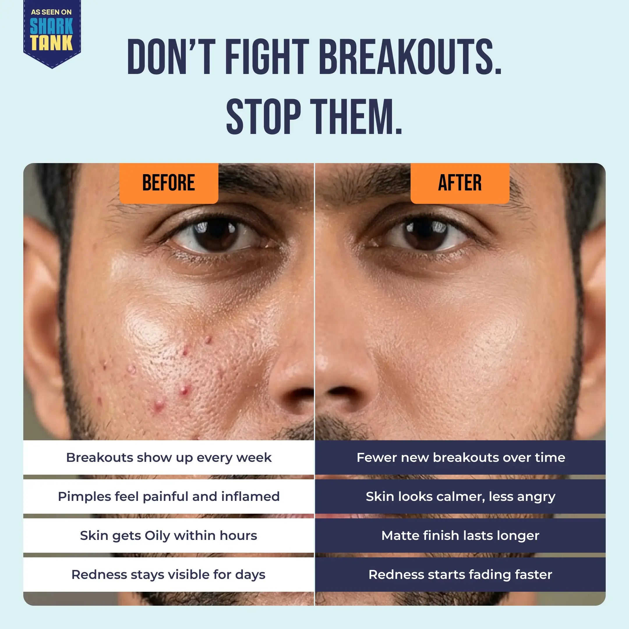 Acne Defense Mucin Serum