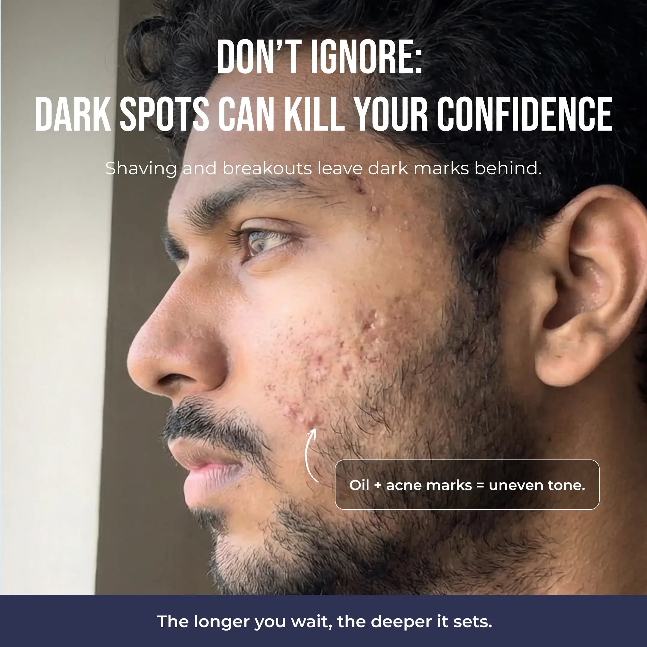 Spot Zero Mucin Serum