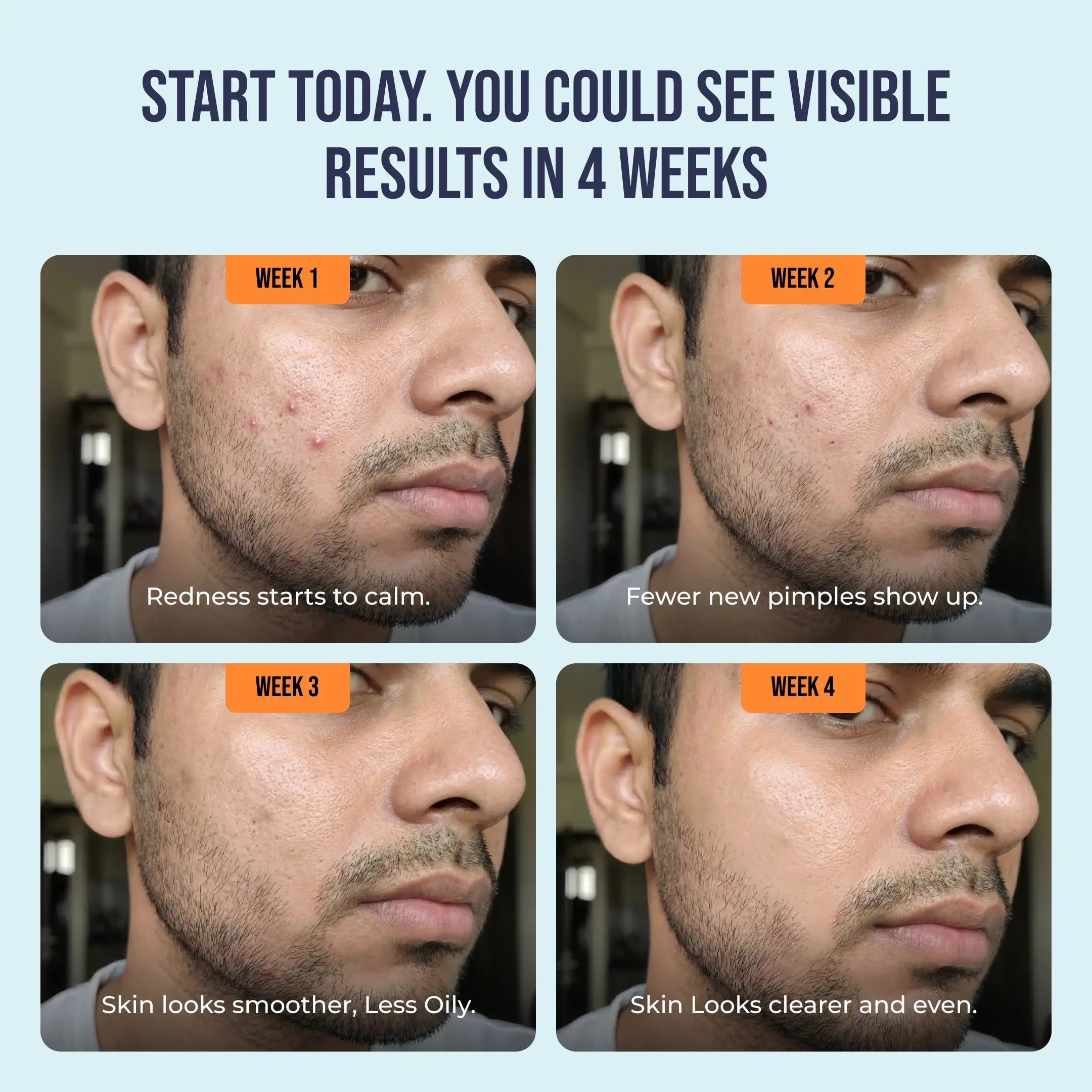 Acne Defense Mucin Serum